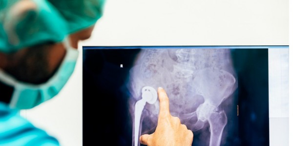 Orthopedic surgeon explaining joint replacement